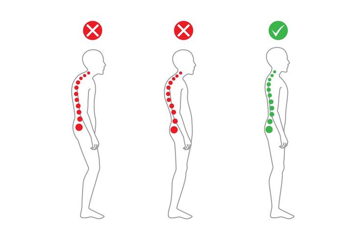 Health is much more than just a clean bill from the doctor or a lean physique. A healthy body is one that’s in proper body alignment without imbalances. Fix Bad Posture, Posture Correction Brace, Posture Fix, Posture Brace, Standing Posture, Forward Head Posture, Posture Exercises, Perfect Posture, Desk Job