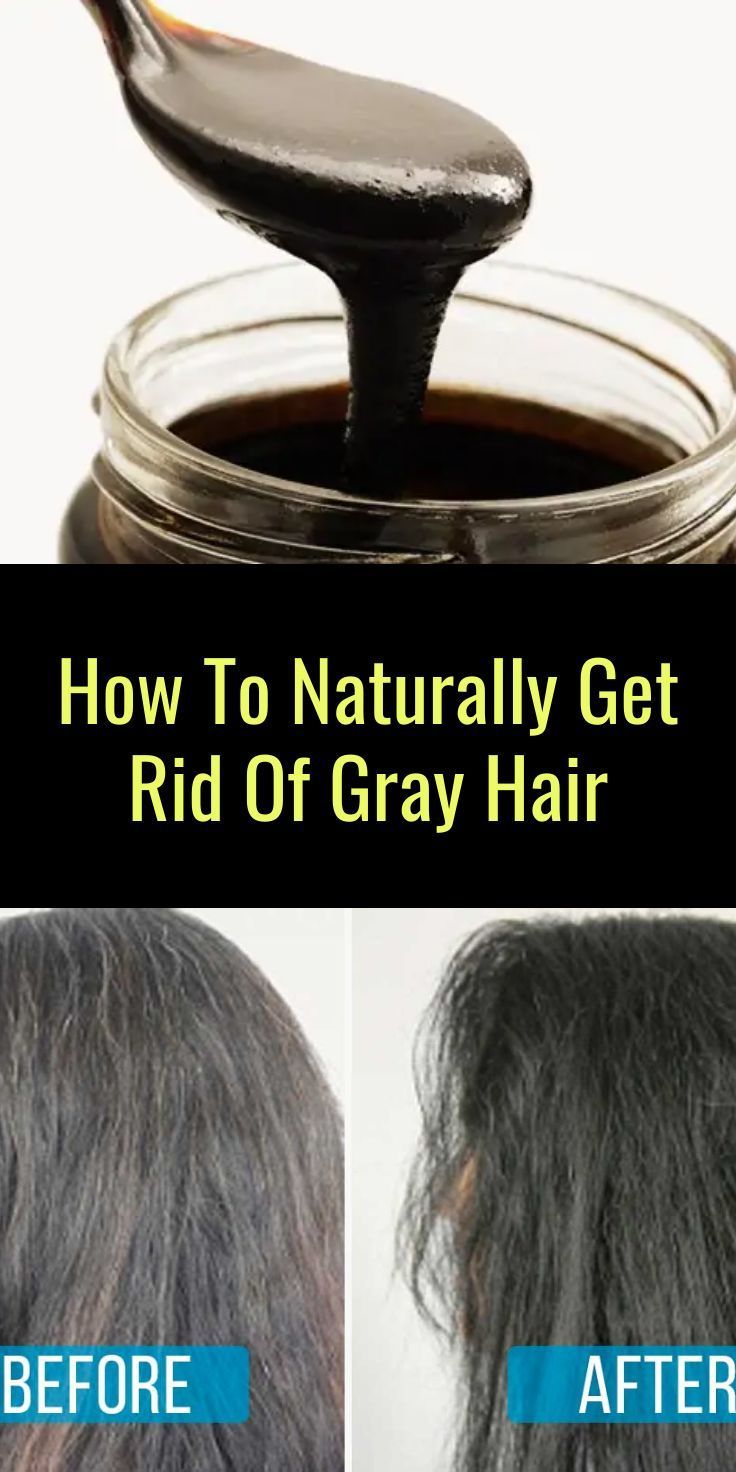 Dye can be bad for your hairHere's how to get rid of gray hairwithout hair dye. Grey Hair Natural Remedy, Grey Hair Home Remedies, Cover Gray Hair Naturally, Remove Gray Hair, Gray Hair Solutions, Grey Hair Remedies, Reverse Gray Hair, Premature Grey Hair, Black And Grey Hair