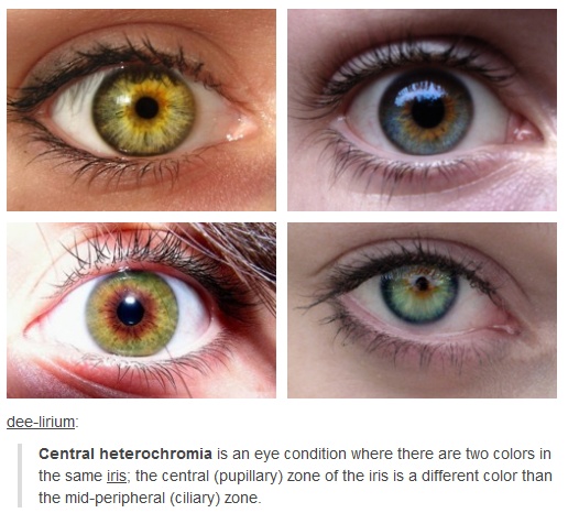 Central Heterochromia love this how I never figured this out about myself is odd but this is me!! Eye Color Facts, Central Heterochromia, Different Types Of Eyes, Eye Facts, Types Of Eyes, Crazy Eyes, Daily Writing, Amazing Pictures, Hazel Eyes