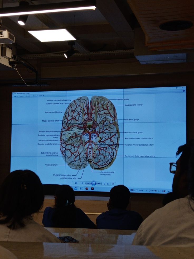 a group of people sitting in front of a large screen with a brain map on it