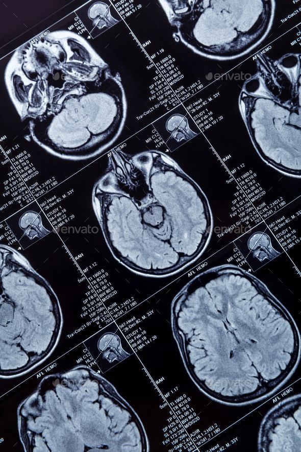 mri images showing different areas of the human brain - stock photo - images and pictures