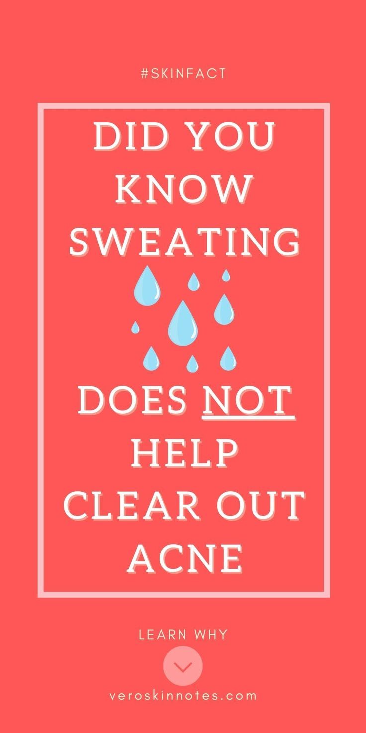 We commonly think sweating (working out, sauna helps with acne by clearing out the pores. This is a skin myth that is not backed by science. Looking at the skin anatomy, it is physically not possible for sweating to help clear acne as we are talking about 2 completely different pores here (sweat glands vs. sebaceous oil glands). Read on to learn why and a lot more (skin facts, skin anatomy, skin science, acne skincare, pimple popping, clear skin beauty tips, skincare tips and the list goes on)! Clear Pimples, Skin Myths, Pimple Causes, Skin Anatomy, How To Clear Pimples, Skin Facts, Pimples Remedies, Acne Skincare, Acne Skincare Routine