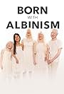 Born with Albinism (2021)