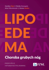 Okładka książki Lipoedema. Choroba grubych nóg. Podejście interdyscyplinarne Karolina Chęś, Monika Domagała, Artur Mieczkowski, Dorota Stettler