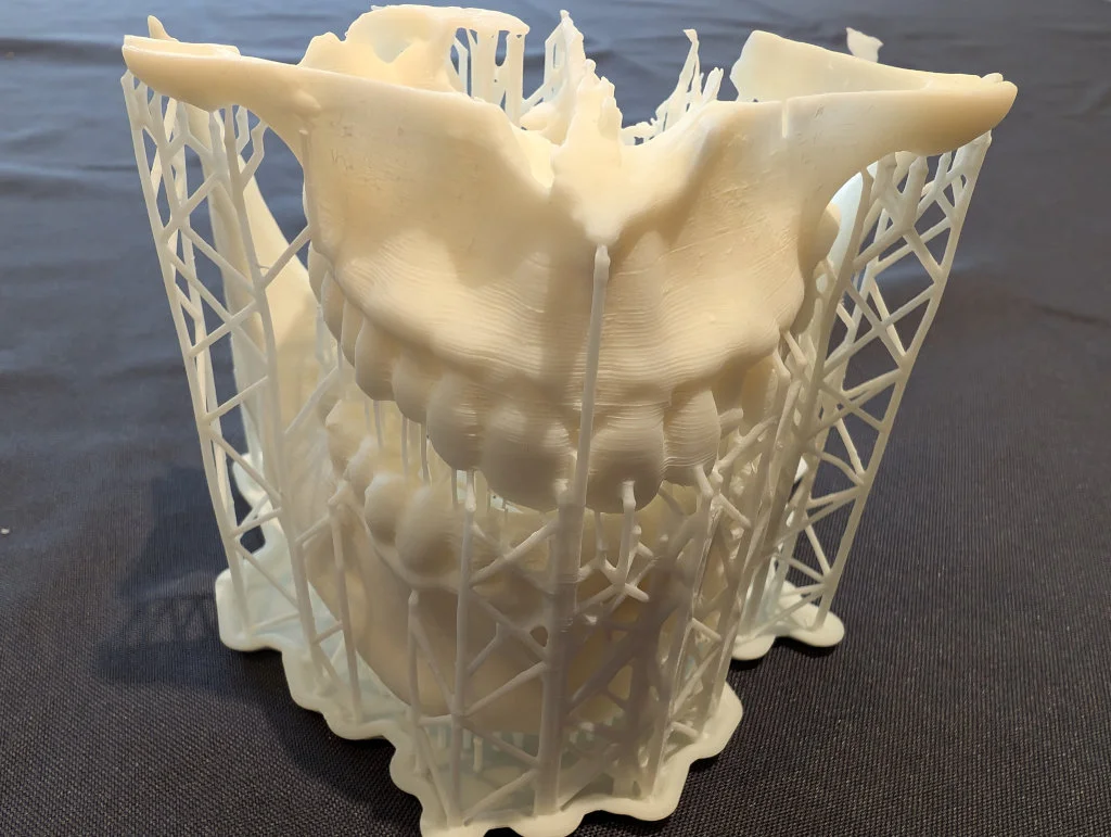 3D printed jaw with resin scaffolding.