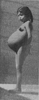 ملف:Lina Medina.jpg