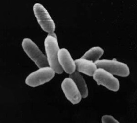 Halobacterium sp. estirpe NRC-1, cada célula c. 5 µm de comprimento.