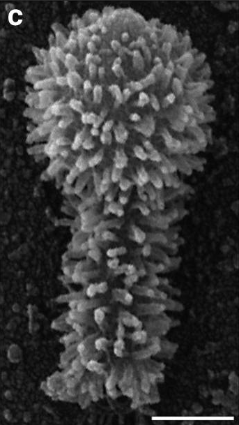 SEM_of_a_Tupanvirus