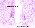 A cross section of the monkey hypothalamus displays 2 of the major hypothalamic nuclei on either side of the fluid-filled 3rd ventricle.