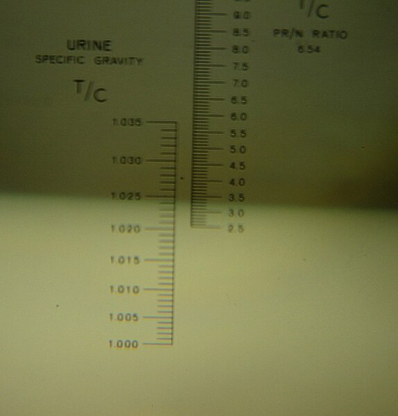 File:Urine specific gravity.JPG