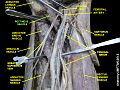 Pectineus muscle