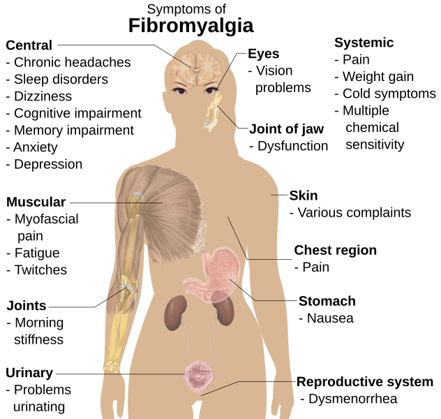 File:Symptoms of fibromyalgia.svg