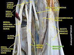 Brachialis muscle (labeled in green text)