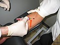 Article: Venipuncture