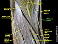 Gracilis muscle