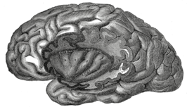 Insula van de linkergrotehersenhelft, na verwijdering van het operculum.