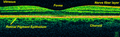 Time-Domain OCT of the macular area of a retina at 800 nm, axial resolution 3 μm