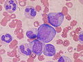 Article: Hematopoyesis