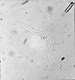 Myxozoans such as Myxobolus cerebralis are single-celled parasites, never more than 20 μm across.