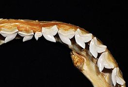 Upper teeth