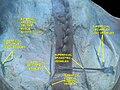 Anterior abdominal wall. Superficial dissection. Anterior view.