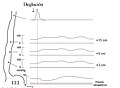 Article: Acalasia, translated into spanish.