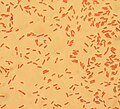 Article: Escherichia coli