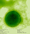 Therumococcus（古細菌）。単独で、鞭毛を持つ球菌。