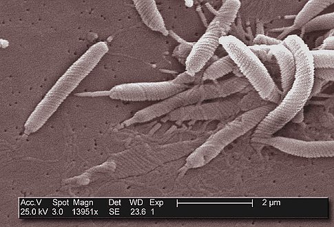 Helicobacter pylori (Proteobacteria)