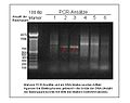 DNA Ladder