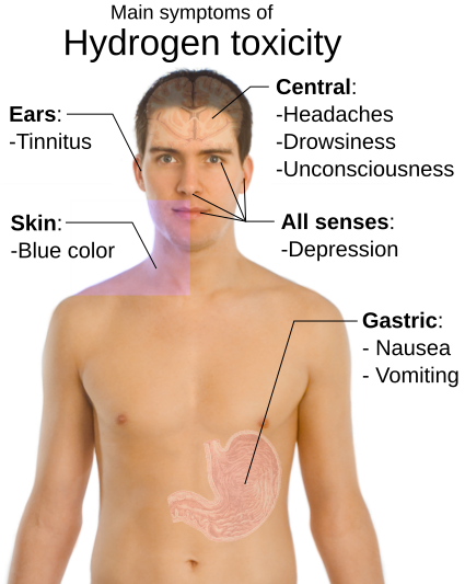 File:Main symptoms of hydrogen toxicity.svg