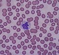 Article: Monocyte