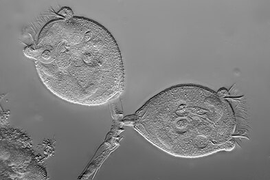 Vorticella (soort gesteelde ciliaten). Op de uiteinden rechts en linksboven zijn de "haartjes" (= de ciliën) zichtbaar waarmee ciliaten voedsel uit het water naar zich toewaaien, zodat het verteerd kan worden.