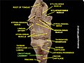 Cricothyroid ligament