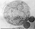 Ignicoccus（古細菌）不定型球菌又は円盤状。表面に別の古細菌が付着している