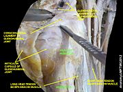 Head of humerus