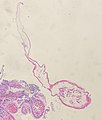 Cross-section of enterobius vermicularis - low magnification