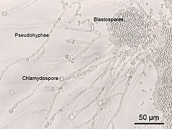 Chlamydospore van de gist Candida albicans