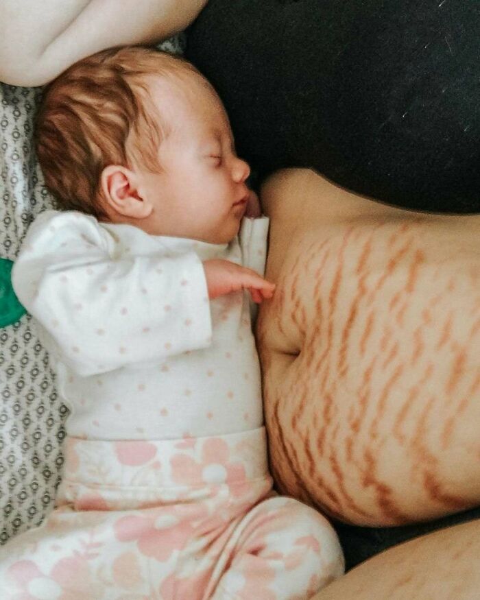 A baby sleeps peacefully on a woman, showcasing real-life moments with visible stretch marks.