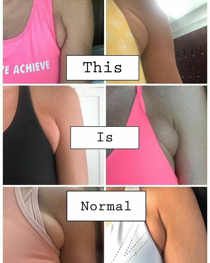 Women in athletic wear showcasing body positivity with text "This Is Normal."