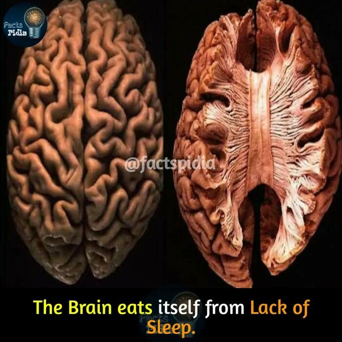 Two brains with detailed textures, showcasing an interesting fact about the effects of sleep deprivation.