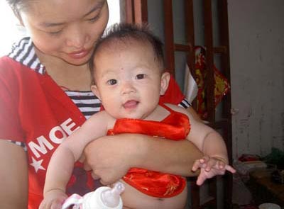 Chinese Baby Born With 12 Fingers and 12 Toes