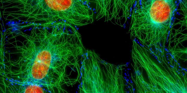 A fluorescent microscope image of NIH 3T3 fibroblast cells